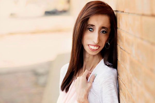 Lizzie Velasquez The World S Ugliest Women Became The Women Of Bravest Heart Filtrends